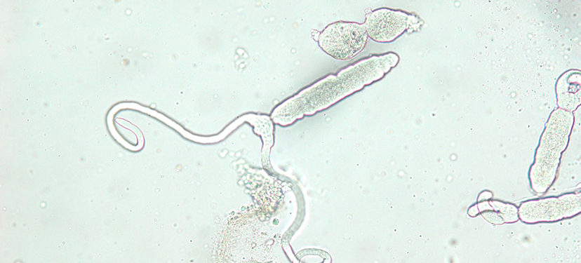 Host-parasite systems as a model for understanding the impacts of ocean acidification and temperature on species interactions: exploring patterns and mechanisms along the natural environmental gradient of the Chilean coast